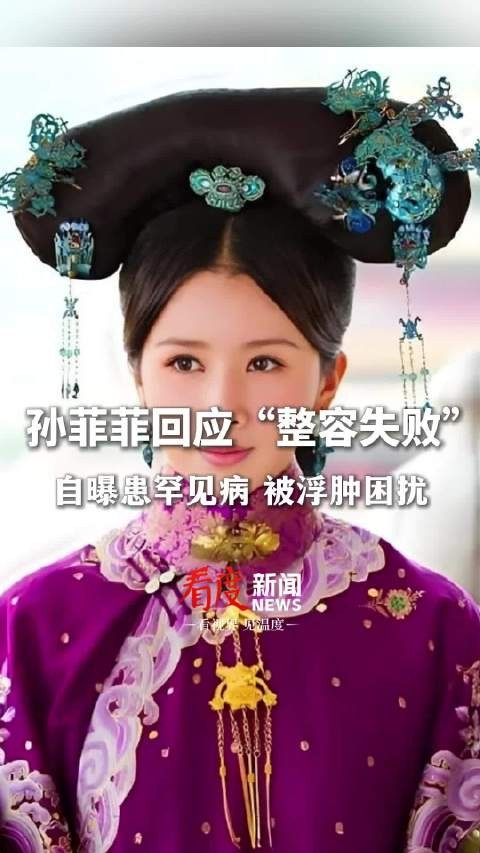 孙菲菲自曝患库欣氏综合症 