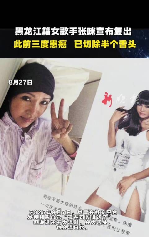 黑龙江女歌手张咪抗癌后复出，曾切除半个舌头
