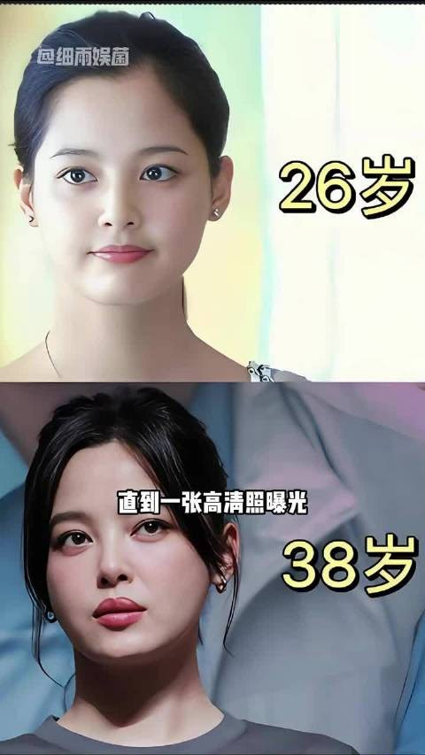 为何辛芷蕾从樱桃小嘴变成“三瓣唇”?一张高清照曝光,原来是我们格局小了