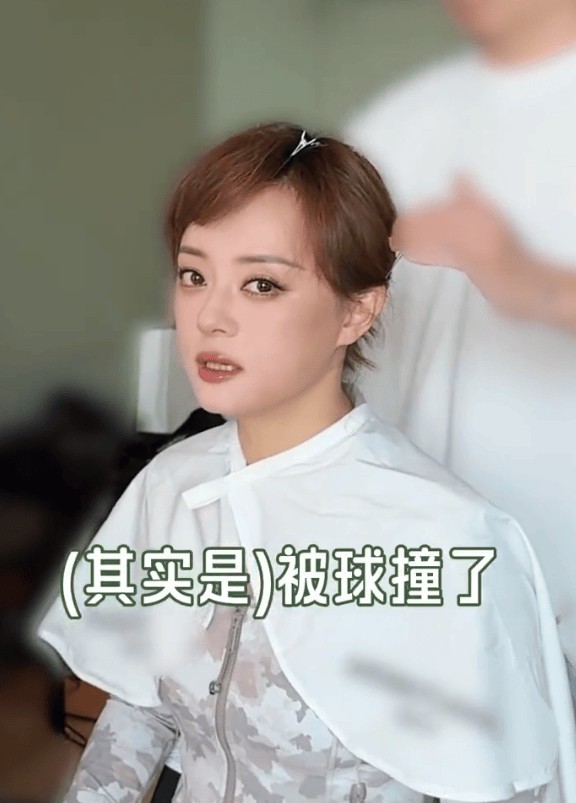 孙俪回应左眼受伤称“被球撞了”！