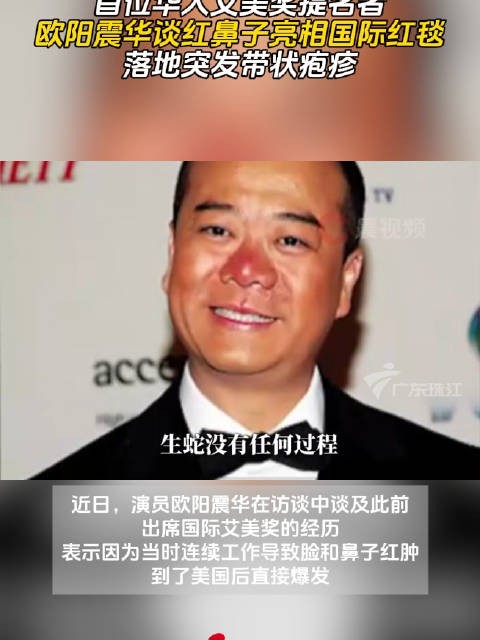 欧阳震华回忆艾美奖提名经历,红毯亮相突发带状疱疹