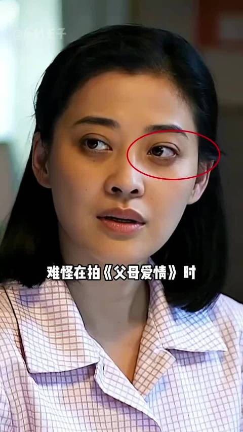 拍《父母爱情》时，为何梅婷的眼圈是黑的？了解内情才懂是我孤陋寡闻了