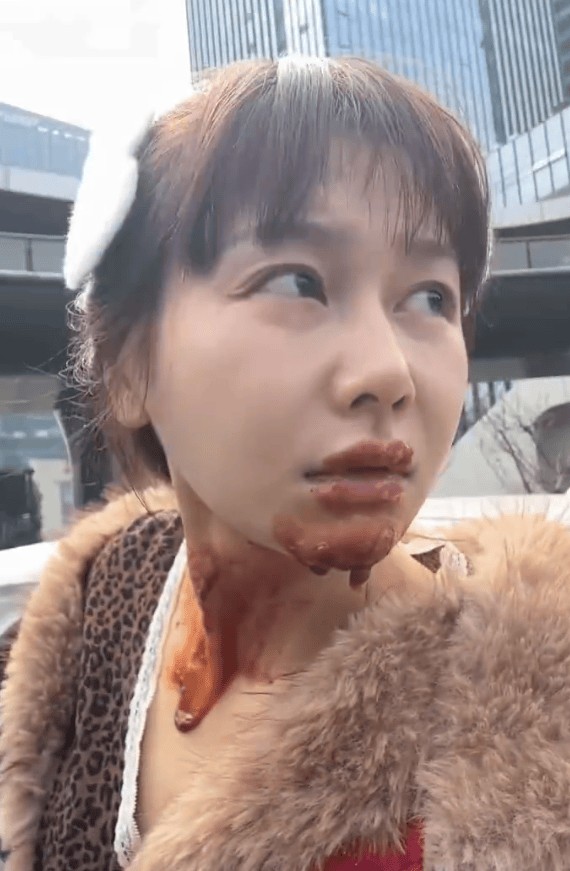 演员王添羽生日模仿“喷火蛋糕” 不慎被火焰反烧脸部