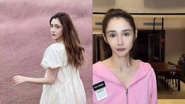 知名女演员4个月暴瘦80斤，颧骨突出双颊凹陷，直播画面让人头皮发麻