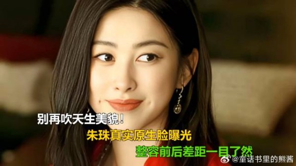 别再吹天生美貌！朱珠真实原生脸曝光，整容前后差距一目了然