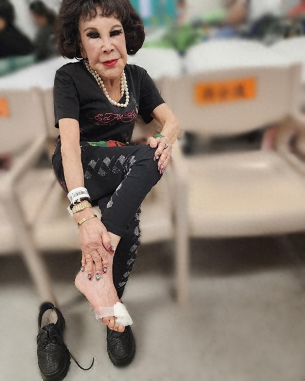 95岁香港女星紧急入院!右脚发炎急症求诊,医院苦等12小时太心酸