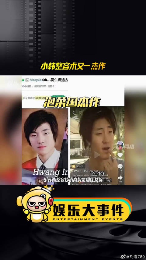 小韩整容术又一杰作,黄寅烨变脸后演上了男二女神降临 医美整容 微博VC计划