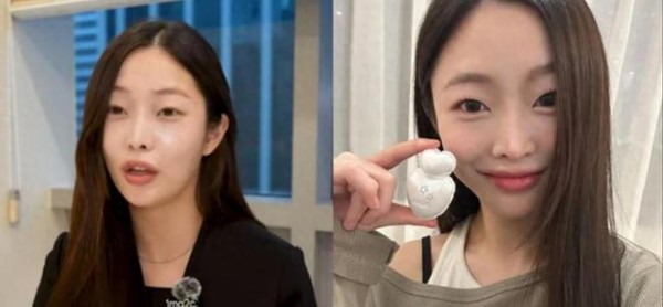 28岁韩国女星改行开整容医院!亲吐真实心声:对娱乐圈已没留恋