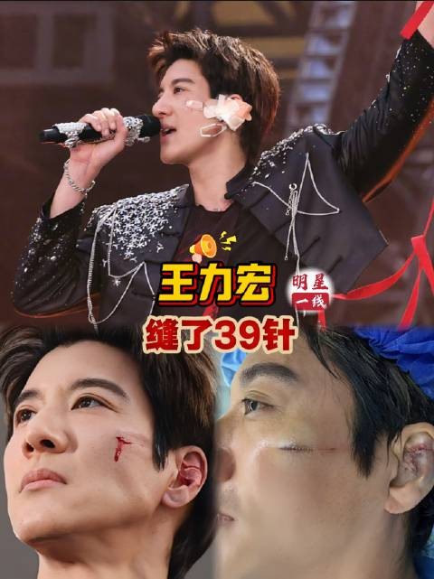 王力宏演唱会跌倒受伤缝39针,凌晨声明报平安