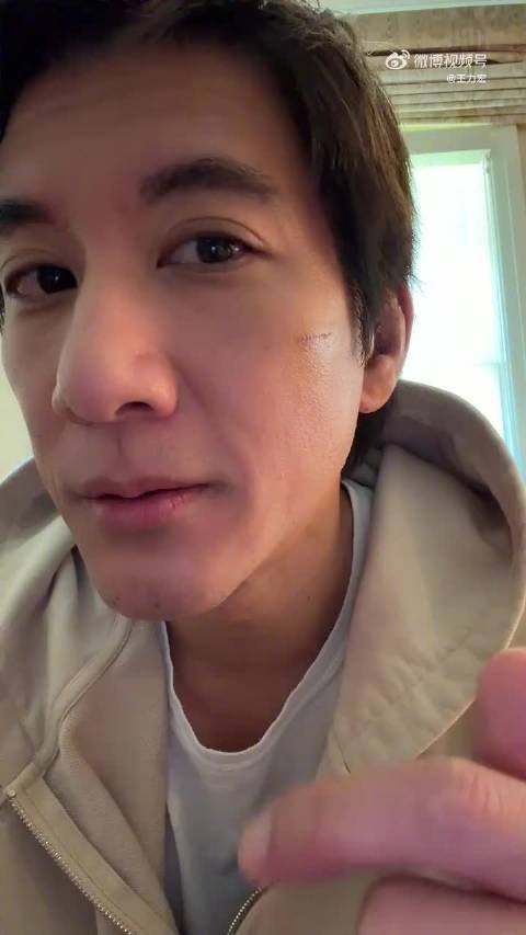 王力宏回应恢复近况：明日拆线