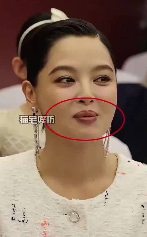 辛芷蕾嘴唇变厚真相曝光，多年误解得解