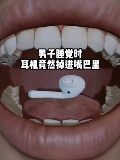 男子睡觉时,耳机竟然掉进嘴巴里 科普