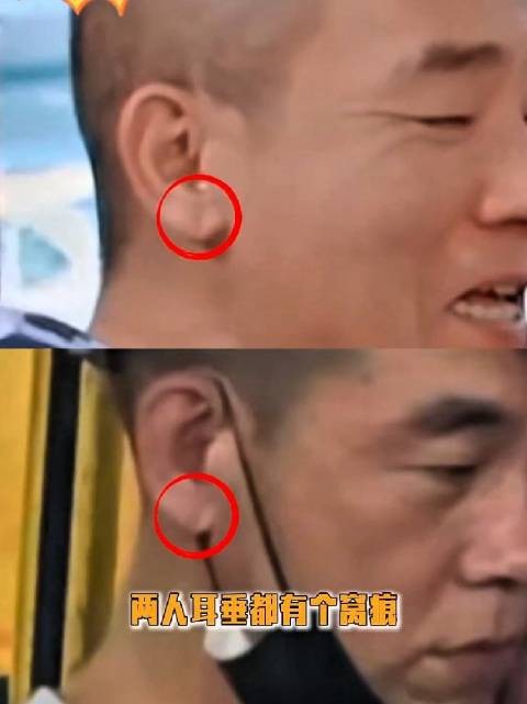 多重巧合层层叠加!陈小春和疑似弟弟耳朵都有个窝痕